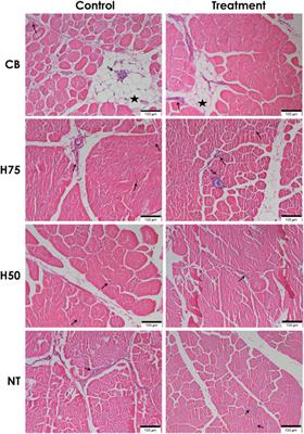 Influences of Thermal Stress During Three Weeks Before Market Age on Histology and Expression of Genes Associated With Adipose Infiltration and Inflammation in Commercial Broilers, Native Chickens, and Crossbreeds